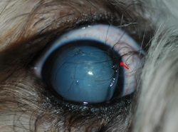 Abb.: Trichiasis